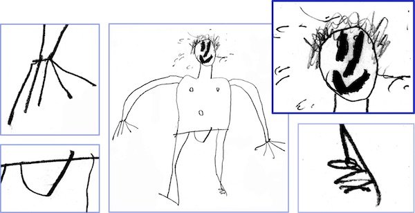 Manic patient or hyperactive child